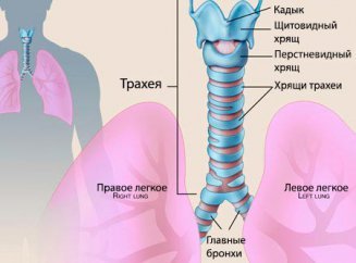  Трахеит вылечил небулайзер